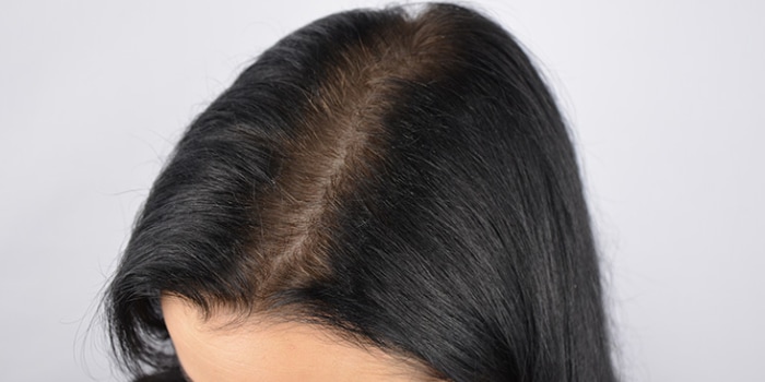Причины выпадения волос после кератинового выпрямления